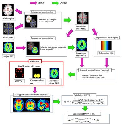 Quantitative Evaluation of 18F-Flutemetamol PET in Patients With Cognitive Impairment and Suspected Alzheimer's Disease: A Multicenter Study